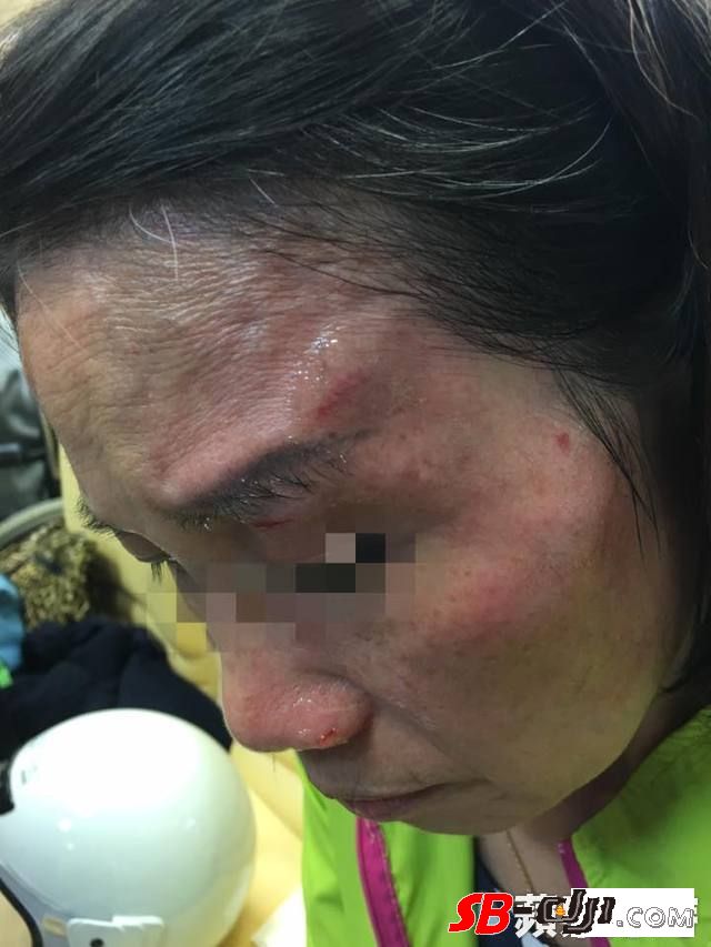 无人机砸伤台北议员妈 民航局:修法予以管理